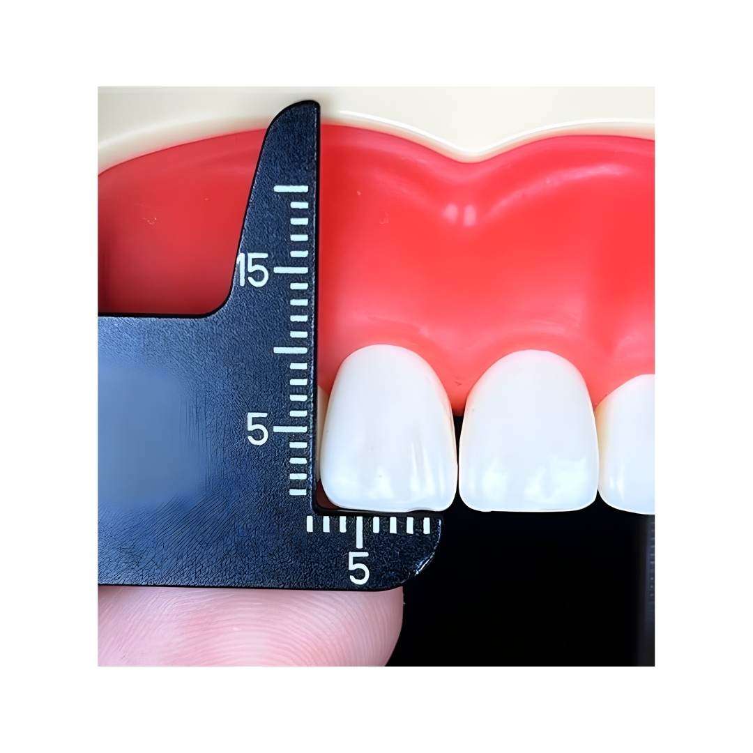 Tooth Meter Dental Ölçüm Cetveli