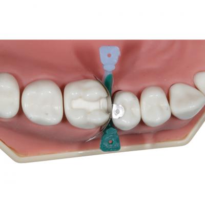 Pratiwedge L803, Anatomik Kama